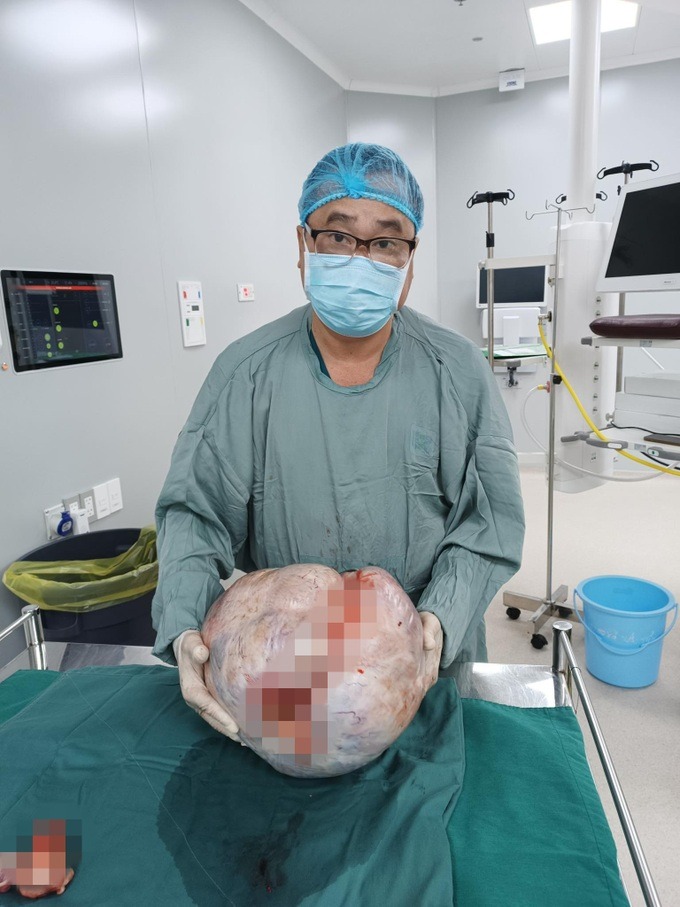 SỐC: Người phụ nữ mang khối u buồng trứng 15kg - 1